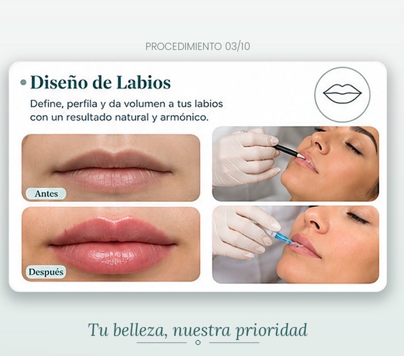 Información visual sobre el procedimiento de diseño de labios